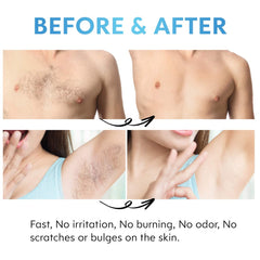 Bleame Crystal Hair Eraser – Painless Exfoliation Hair Removal Tool For Arms Legs Back – Apply To Any Part Of The Body – China (random Color)