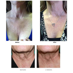 Bioaqua Collagen Anti-aging Neck Repair Cream