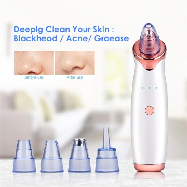 Vaccum Acne Pimple, Black Spot | Blackhead Remover For Nose,facial Pore Acne Grease Cleaner Skin Care (random Color)