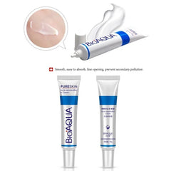 Bioaqua Acne Cream | Bio Aqua Removal Of Acne
