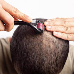 Skin Therapy 0.5 Derma Roller With 540 Micro Needle Roller For Men And Women | Derma Roller 540 Titanium Needle (0.5mm)